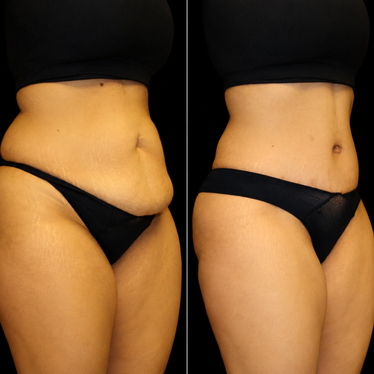 LumieraLean | Pro Red Light Belt